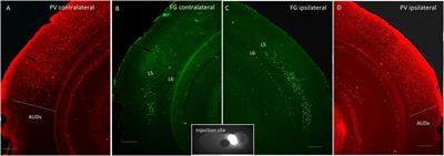 Patterns of Unilateral and Bilateral Projections From Layers 5 and 6 of the Auditory Cortex to the Inferior Colliculus in Mouse